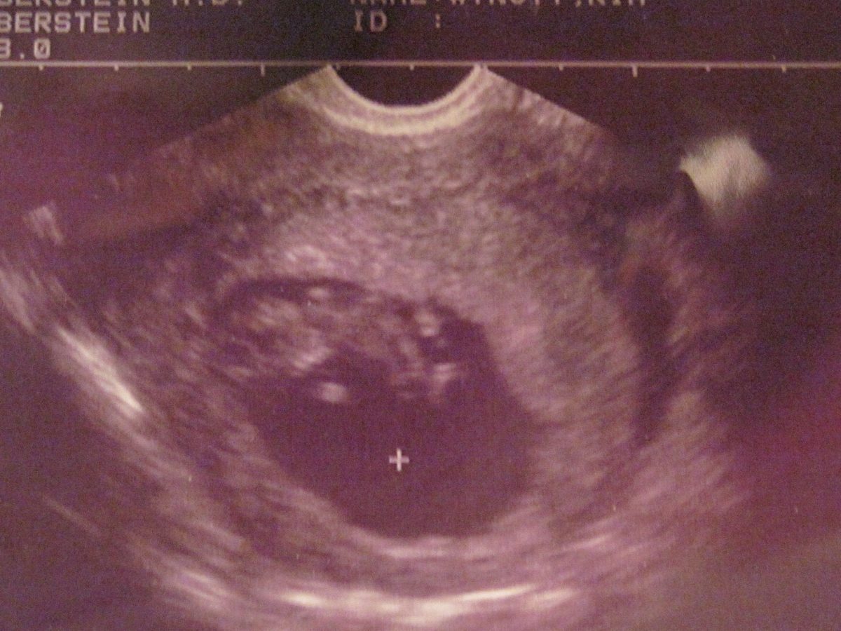 “I’m pro-choice too.”