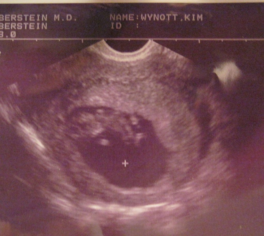 “I’m pro-choice too.”